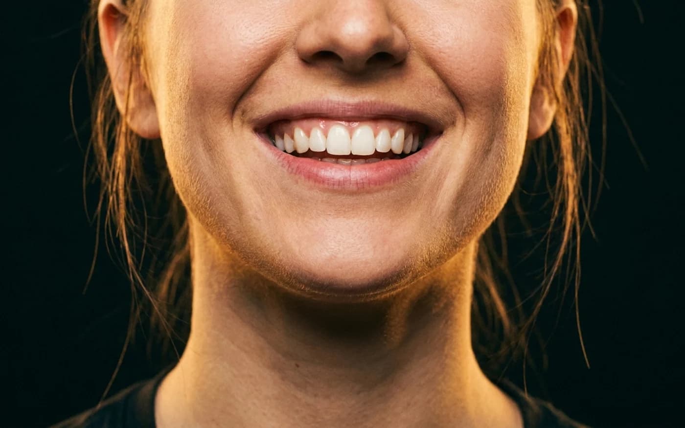 Sorriso gengival: por que aparece muita gengiva e como corrigir
