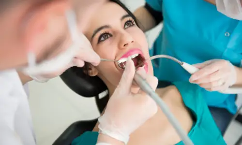 profilaxia periodontal