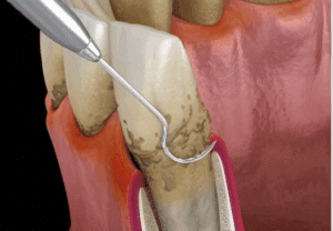 Doença periodontal e saúde geral